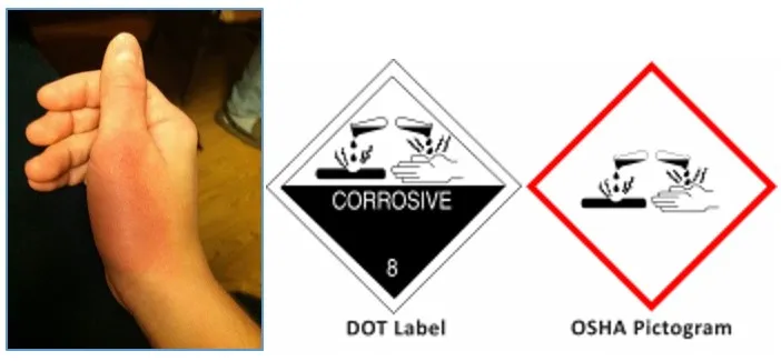 Burned hand image left and two warning labels on the right