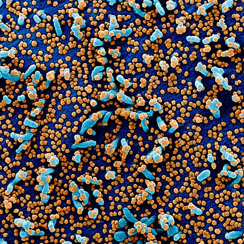 Novel Coronavirus SARS-CoV-2