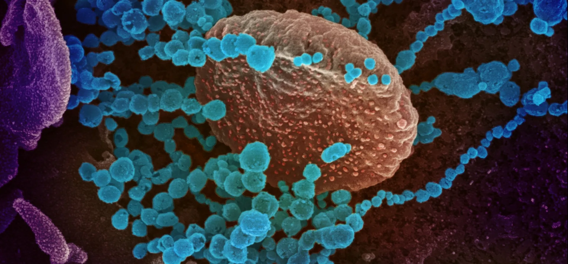 Novel Coronavirus SARS-CoV-2